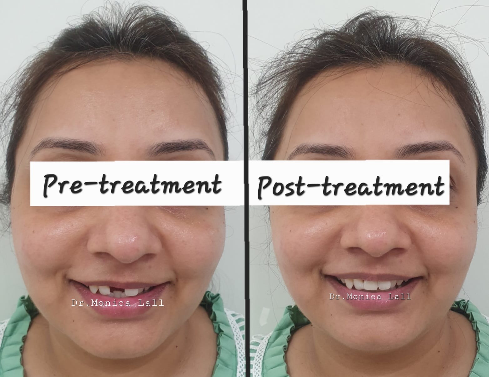 Dental Transformation